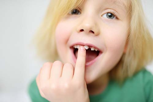 Advanced Stages of Tooth Decay in Toddlers