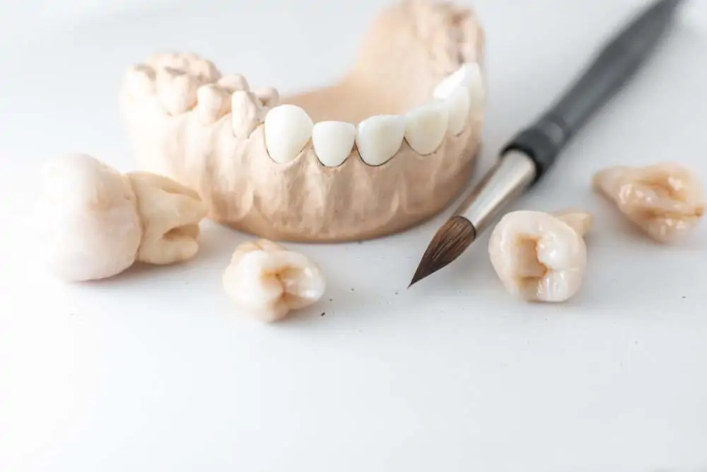 Veneers vs. Crowns