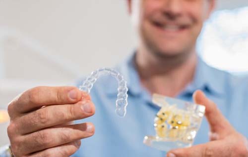 The Differences between Smile Direct vs. Invisalign
