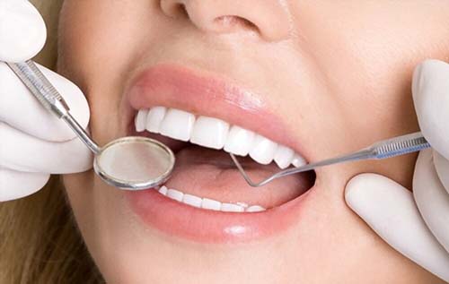 Porcelain Veneers in Turkey