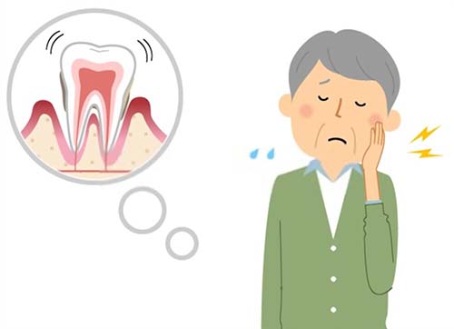 Symptoms of a Root Canal 1