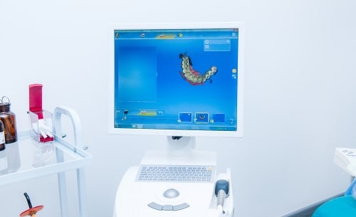 Computer Guided Dental Implant