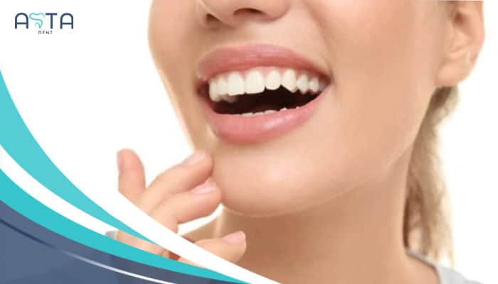 Tooth Bonding VS. Veneers new 2024