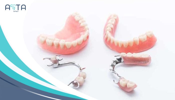 Everything You Need To Know About Dentures new