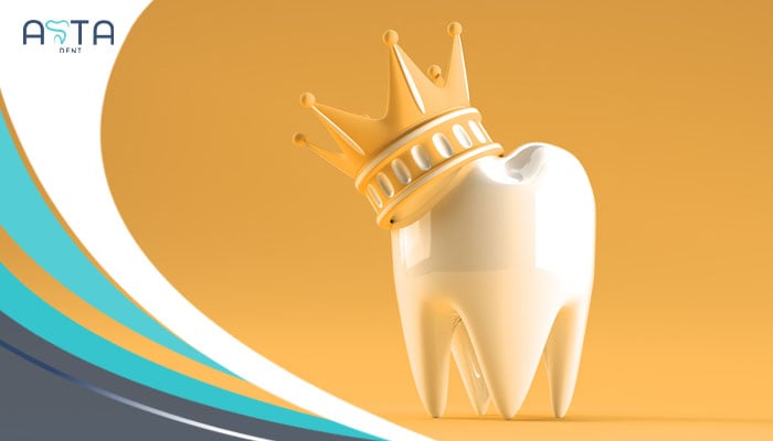 Teeth Crowns new 2024