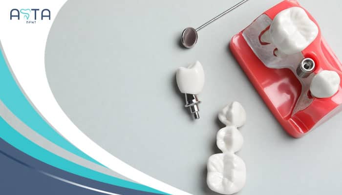 dental implants in Turkey new 2024