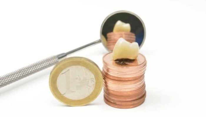 Veneers Cost In Turkey 2