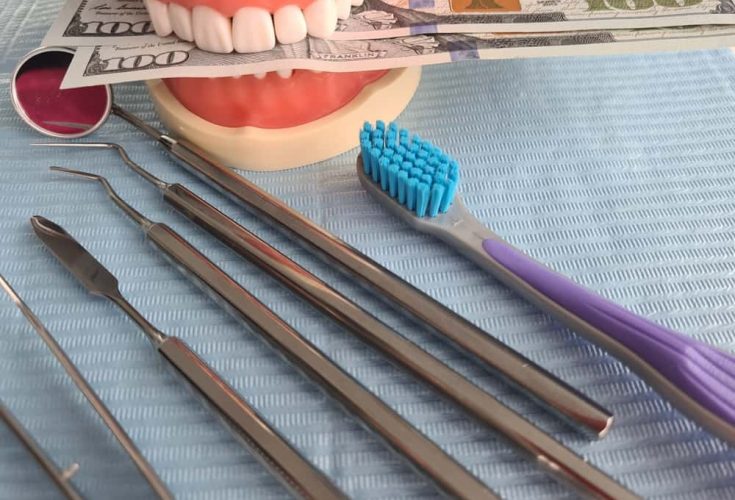 Veneers Cost