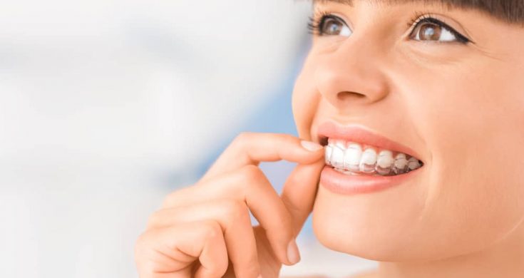 What-Is-Invisalign-And-How-Does-It-Work